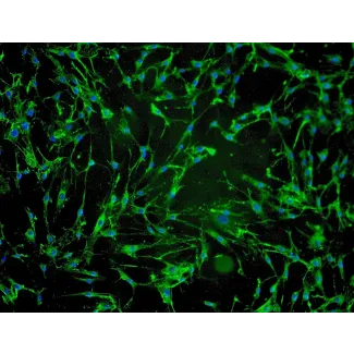 Human Hair Dermal Papilla Cells (HHDPC) - Immunostaining for Fibronectin, 100x.
