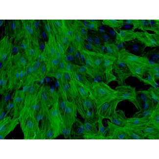 Human Hepatic Stellate Cells (HHSteC) - Immunostaining for α-SMA, 200x.
