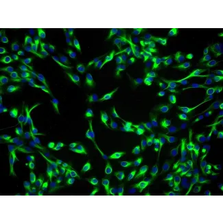 Human Lens Epithelial Cells (HLEpiC) - Immunostaining for CK-19, 200x.
