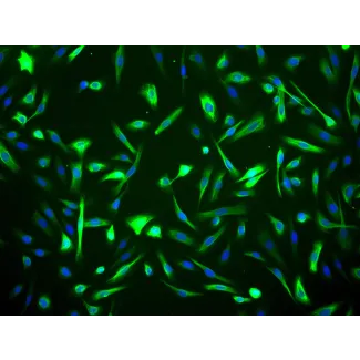 Human Mammary Epithelial Cells (HMEpiC) - Immunostaining for CK-18, 200x.
