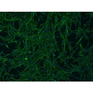 Human Mammary Fibroblasts (HMF) - Immunostaining for Fibronectin, 100x
