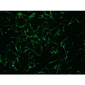 Human Neurons HN - immunostained for beta tubulin III (green), 200x
