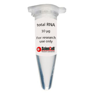 Human Oral Keratinocyte Total RNA