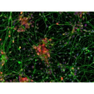 Human Pluripotent Stem Cell-derived Cortical Neuron Modeling Kit
