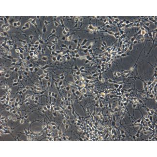 Human Pluripotent Stem Cell-derived Midbrain/Dopaminergic Neuron Modeling Kit