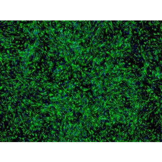 Human Retinal Pigment Epithelial Cells (HRPEpiC) - Immunostaining for CK-18, 200x.
