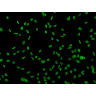 Human Sertoli Cells (HSerC)-Immunostaining for SOX-9, 200x.

