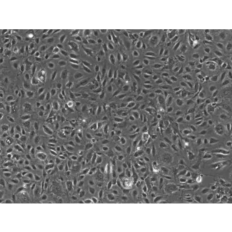 Human Testicular Endothelial Cells (HTEC)-Phase contrast, 100x.
