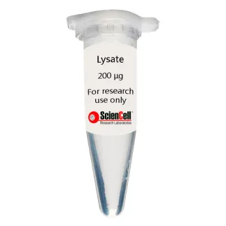 Human Umbilical Artery Endothelial Cell Lysate