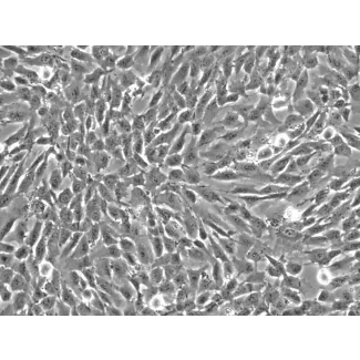 Human Vertebral Mesenchymal Stem Cells (HVMSC) - Phase contrast, 200x.
