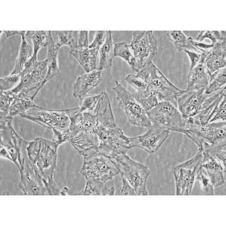 Human Villous Trophoblasts (HVT) - Phase Contrast, 400x

