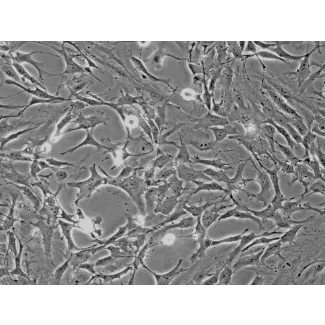 Mouse Astrocytes-cerebellar (MA-c) - Phase contrast, 200x.
