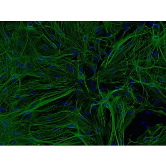 Mouse Astrocytes-hippocampal (MA-h) - Immunostaining for GFAP, 200x.
