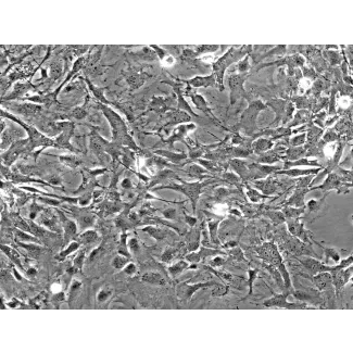 Mouse Astrocytes-spinal cord (MA-sc) - Phase contrast, 200x.
