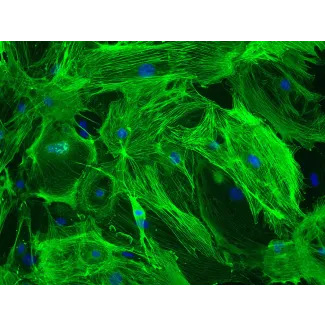 Mouse Brain Vascular Pericytes (MBVP)-Immunostaining for α-SMA, 200x
