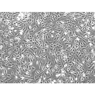 Mouse Embryonic Fibroblasts (MEF) - Phase contrast, 100x.
