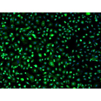 Mouse Hepatic Mesothelial Cells (MHMeC) - Immunostaining for Mesothelin, 200x