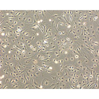 Mouse Hepatic Mesothelial Cells (MHMeC) - Phase Contrast, 100x