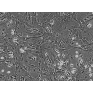 Mouse Hepatic Stellate Cells (MHSteC) - Phase contrast, 100x.
