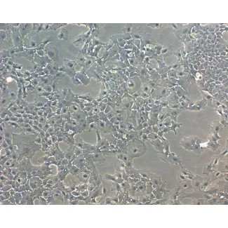 Mouse Lens Epithelial Cells (MLEpiC) - Phase Contrast, 100x