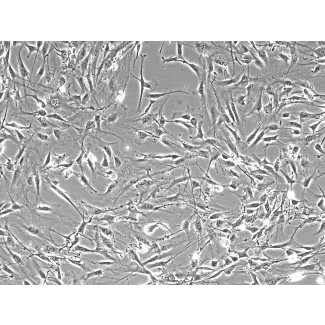 Mouse Lymphatic Fibroblasts (MLF) – Phase Contrast, 100x
