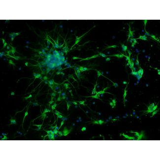 Mouse Neurons-forebrain (MN-fb)-Immunostaining for b-tubulin III, 200X