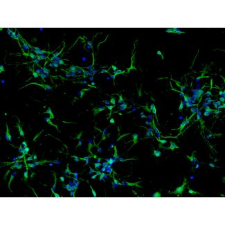 Mouse Neurons-midbrain (MN-mb)-Immunostaining for β-tubulin III, 200X