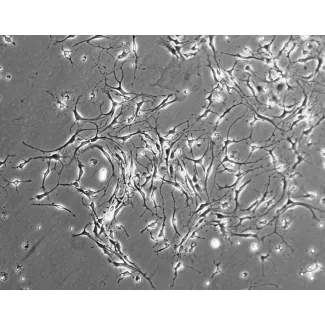 Mouse Neurons-striatal (MN-s) - Phase contrast, 100x.
