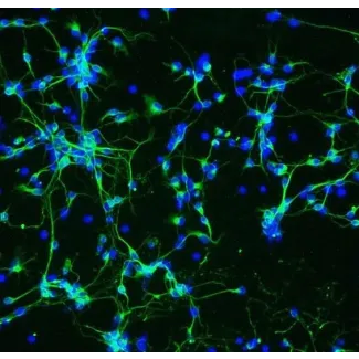 Mouse Neurons-substania nigra (MN-sn) - Immunostaining for β-Tubulin III, 200x.

