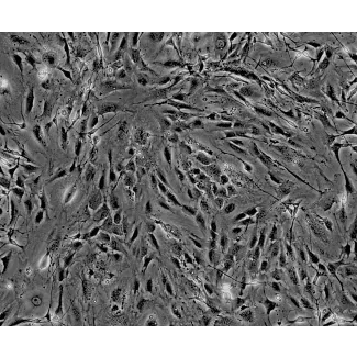 Isolated from postnatal day 8 C57BL/6 mouse sciatic nerve. MPNF are cryopreserved at passage one and delivered frozen. Each vial contains >5 x 10^5 cells in 1 ml volume.