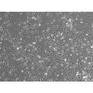 Mouse Pulmonary Alveolar Macrophages (MPAMa) - Phase contrast, 100x
