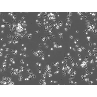 Mouse Pulmonary Alveolar Macrophages (MPAMa) - Phase contrast, 100x
