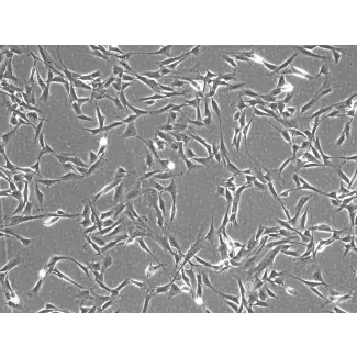 Rabbit Cardiac Fibroblasts (RabCF) – Phase Contrast, 100X.