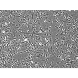 Rabbit Renal Mesangial Cells (RabRMC) – Phase Contrast, 100X.
