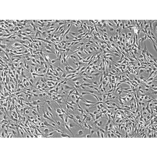 Rat Astrocytes-adult – Phase Contrast, 100x
