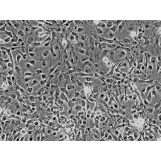 Rat Astrocytes-cerebellar (RA-c) - Phase contrast, 200x.
