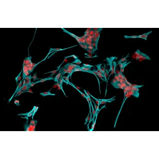Rat Astrocytes-cerebellar (RA-h) - Immunostaining for GFAP, 200x.
