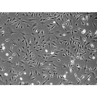 Rat Cardiac Fibroblasts (RCF) - Phase contrast, 100x.