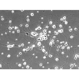 Rat Cerebellar Granule Cells (RGC) - Phase contrast, 200x.
