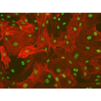 Rat Hepatic Stellate Cells (RHSteC) - Immunostaining for α-SMA, 200x.

