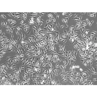 Rat Microglia (RM) - Phase contrast, 100x.
