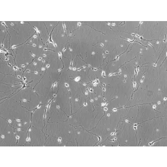 Rat Neurons-hippocampal (RN-h) - Phase contrast, 200x.
