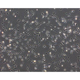 Rat Perineurial Fibroblasts (RPNF) - Phase contrast, 100x.
