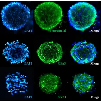 Human Cortical Spheroids at Day 7