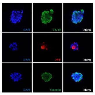 Human mini liver spheroids express hepatocyte marker cytokeratin 18 (CK-18), stellate cell marker vimentin and sinusoidal endothelial cell marker von Willebrand factor (vWF). 