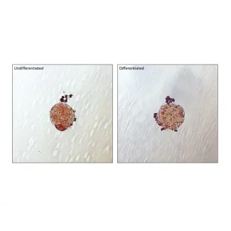 Lipid droplets are visible in Human Preadipocyte spheroids after 5 days of culture in differentiation medium