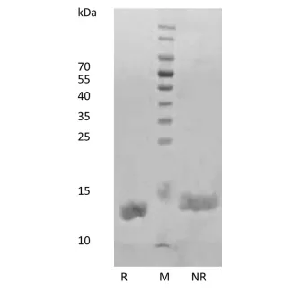 Recombinant Human Interleukin-2
