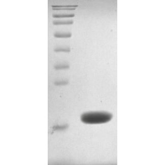 Recombinant Human UbE2D3