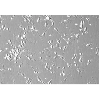 人小脑颗粒细胞 (HCGC) - 相差显微镜，200倍。