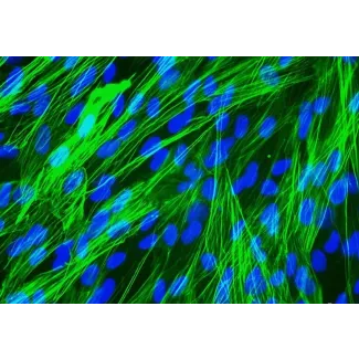 人支气管平滑肌细胞（HBSM）- vWF免疫染色。